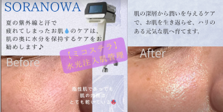 季節によるお肌のケア